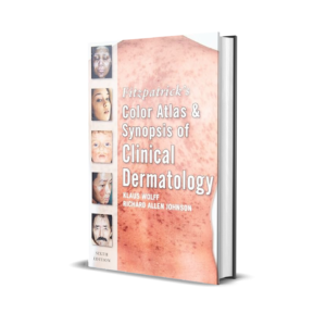 Fitzpatrick's Color Atlas and Synopsis of Clinical Dermatology: Sixth Edition 6th Edition