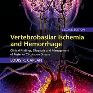 Vertebrobasilar Ischemia and Hemorrhage: Clinical Findings, Diagnosis and Management of Posterior Circulation Disease