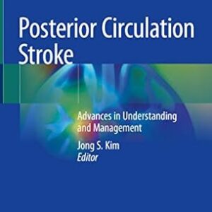 Posterior Circulation Stroke: Advances in Understanding and Management