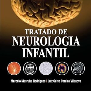 Tratado de Neurologia Infantil